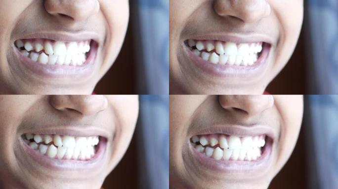 十几岁的男孩微笑着健康的洁白牙齿。