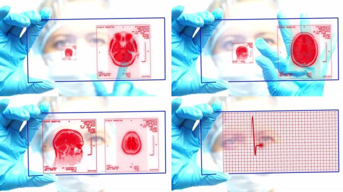 医疗技术概念。远程医学。电子病历。医生检查计算机断层扫描和心电图的全息模型