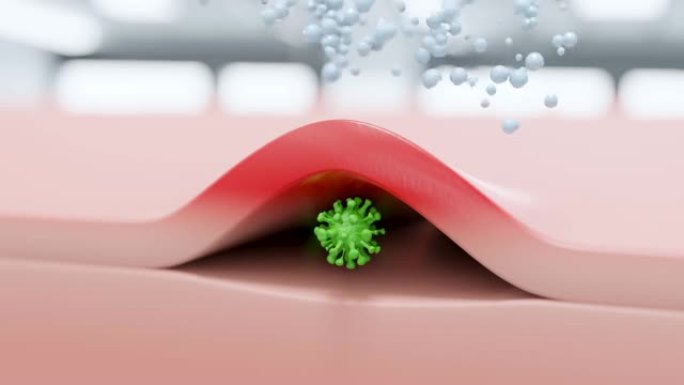 病毒皮下炎症，疱疹-3d动画显示病毒象征性皮炎，并用乳膏治疗。