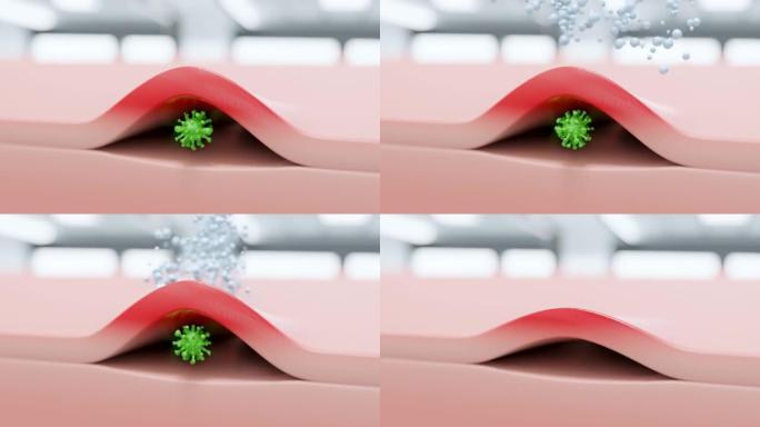 病毒皮下炎症，疱疹-3d动画显示病毒象征性皮炎，并用乳膏治疗。