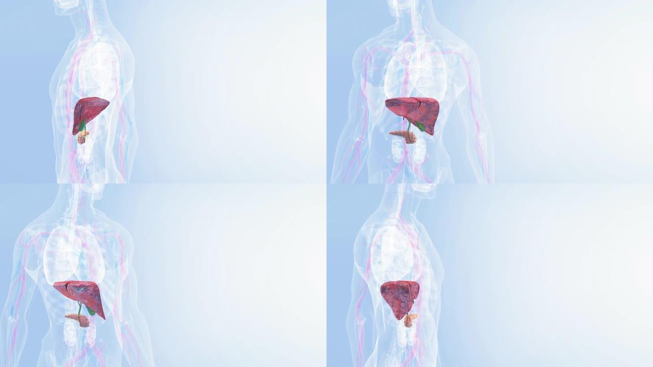 人体肝脏解剖三人模型