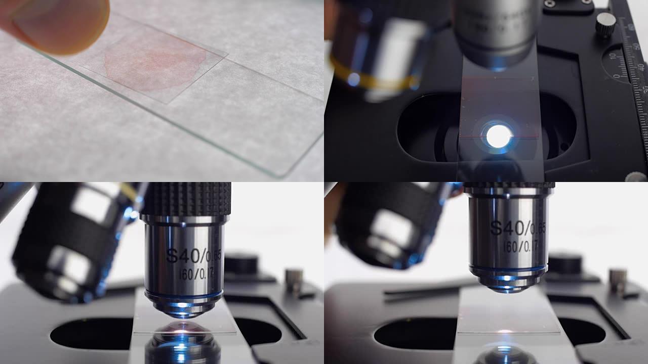 将血液 (红色液体) 样本放在显微镜的载玻片上