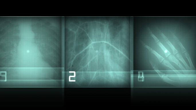 医学用的神秘X光片显示出骨骼手掌骨等