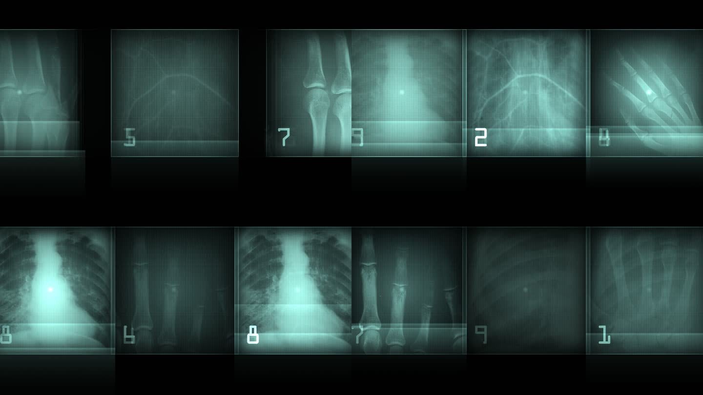 医学用的神秘X光片显示出骨骼手掌骨等