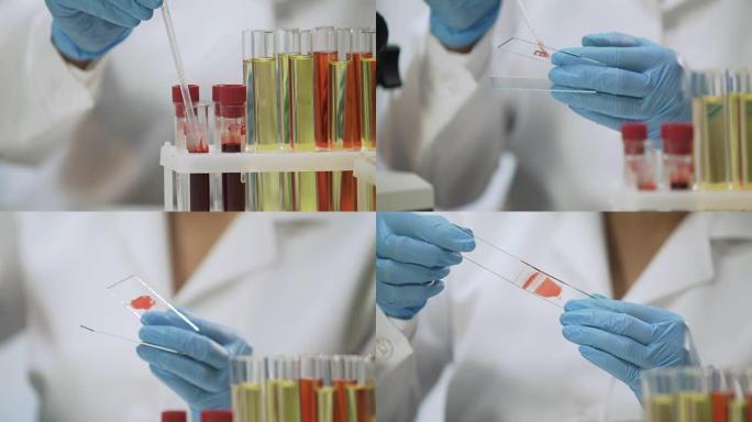 细菌学家分析微生物标本，血液样本，HIV检测