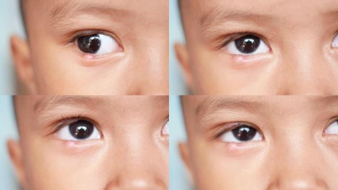感染儿童眼罩的特写镜头，下眼睑疼痛。眼病。眨眼的眼睛