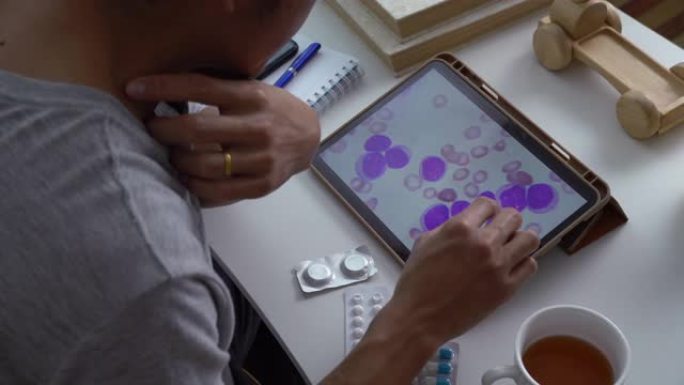 亚洲男性通过数字平板电脑寻找血液白血病细胞，以了解自己的白血病阶段。