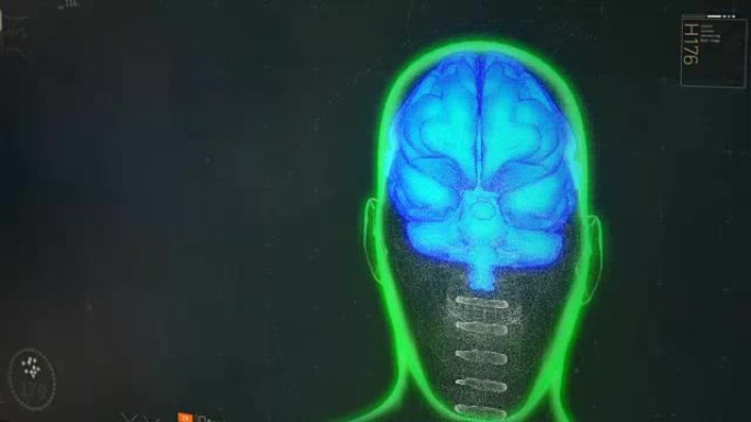 人脑模型在屏幕上旋转，计算机程序显示扫描结果