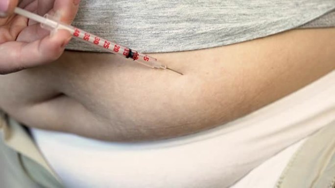 超重女性向胃注射胰岛素，糖尿病的特写