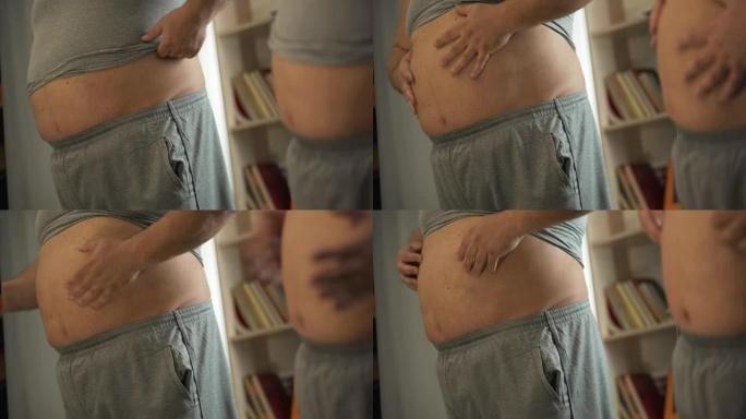 体重超重的男性站在镜子前触摸他肥胖的肚子