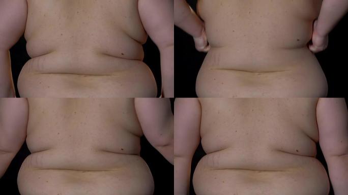 肥胖的男人心烦的腰部脂肪褶皱，减肥困难，暴饮暴食的效果