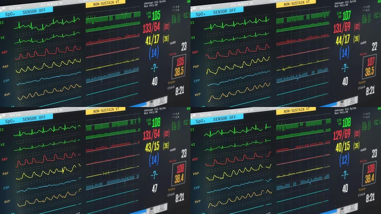 ICU监护仪显示患者的情况，高温，心律失常，疾病