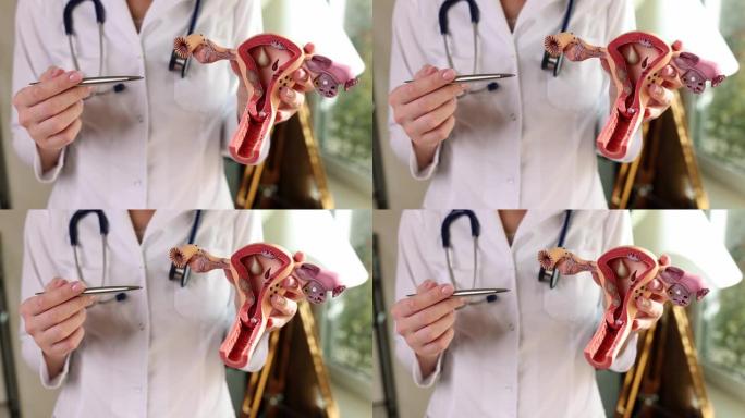 女性生殖系统的解剖和妇科医生显示患者的器官结构