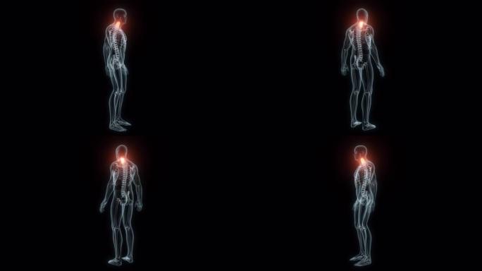 颈椎医学动画的3D渲染。颈椎x线片。