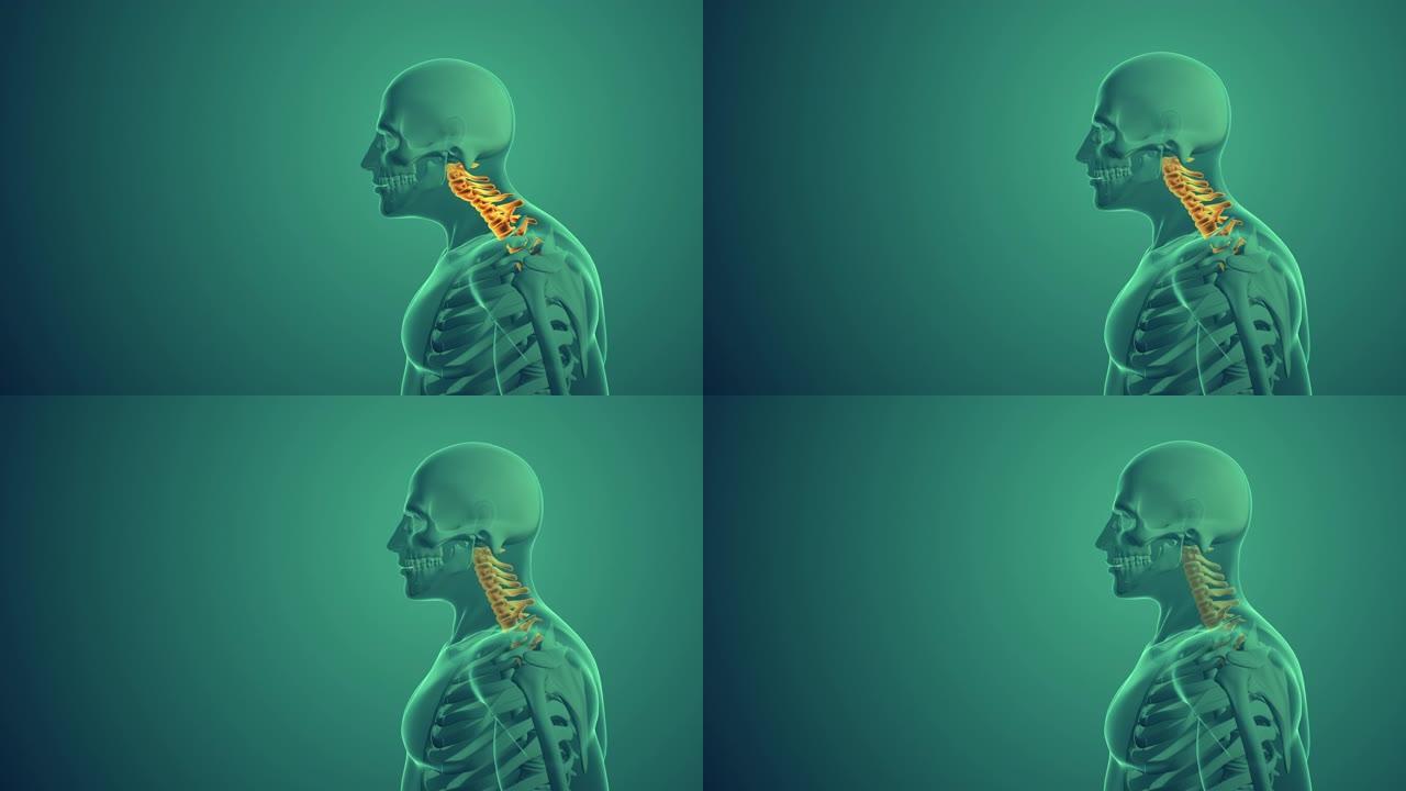 颈椎姿势综合征医学背景