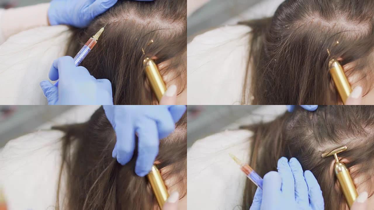 美容师用维生素和营养刺破头部皮肤