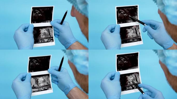 手术室的医生分析人体肾脏8毫米中结石或结石的超声。一位专家医生检查如何从输尿管上清除结石