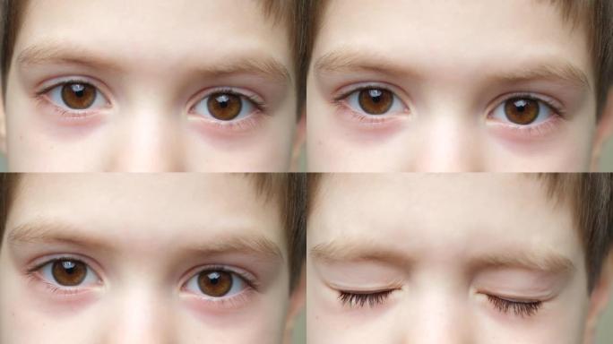一个5岁的严肃男孩看着镜头，眯着眼睛，棕色的眼睛的样子