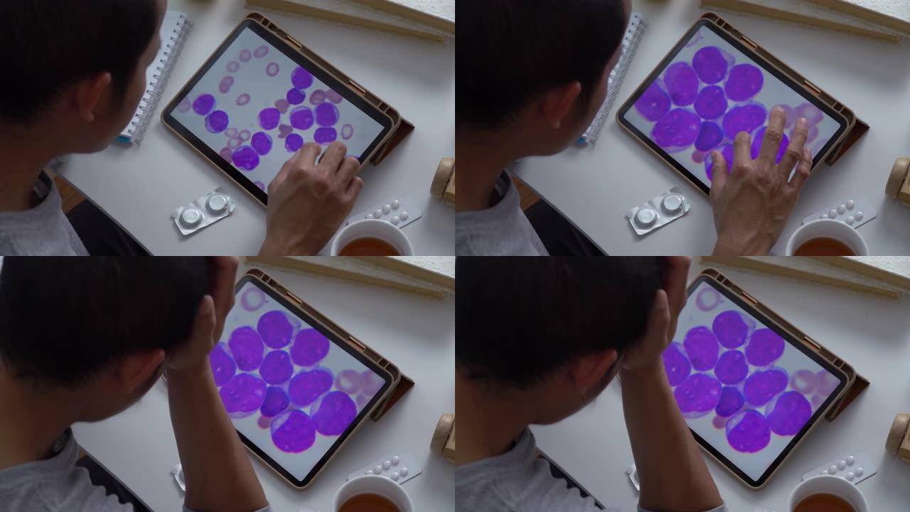 亚洲男性通过数字平板电脑寻找血液白血病细胞，以了解自己的白血病阶段。