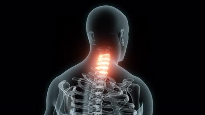颈椎医学动画的3D渲染。颈椎x线片。