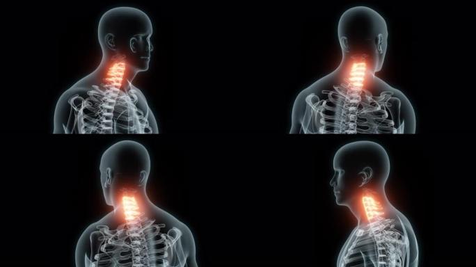 颈椎医学动画的3D渲染。颈椎x线片。