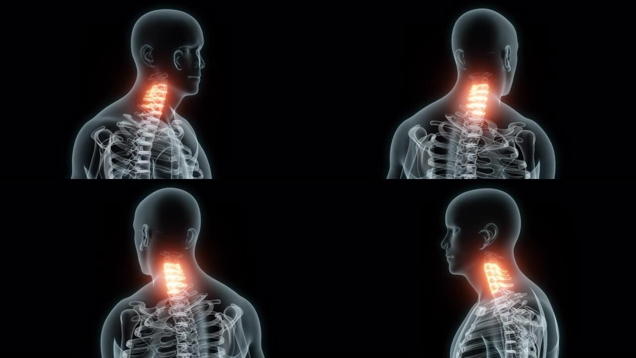 颈椎医学动画的3D渲染。颈椎x线片。