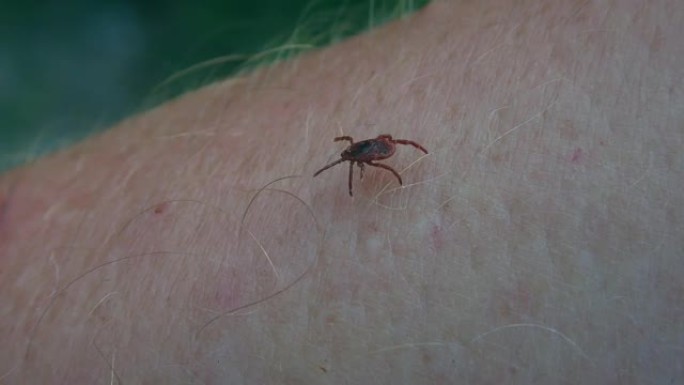 人类皮肤上危险的寄生虫伊科蜱。