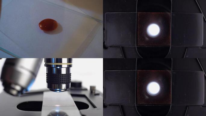 将血液 (红色液体) 样本放在显微镜的载玻片上