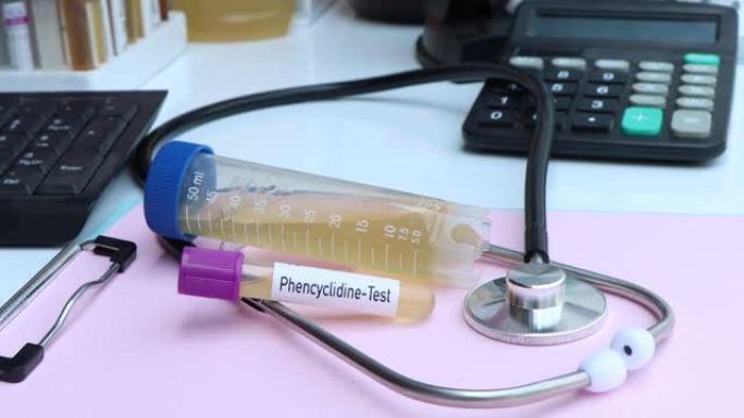 苯环利定测试从尿液中寻找异常