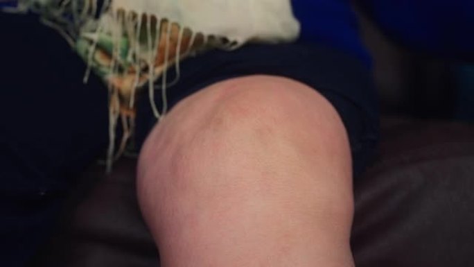 高级妇女在膝盖上使用止痛药带
