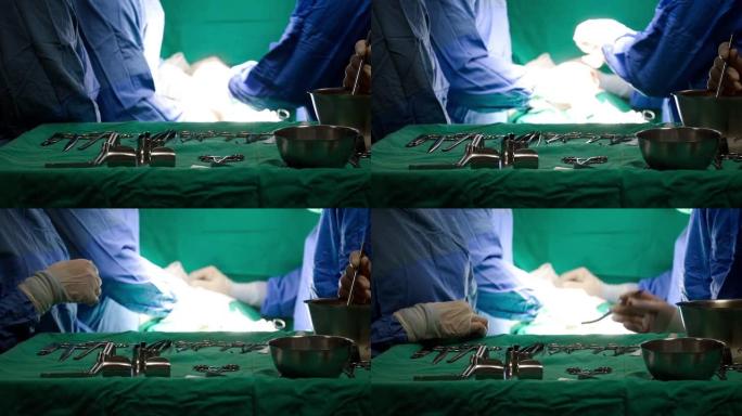 4k特写手术套件表。针对流感背景的外科剪刀和注射器。录像显示医生在后台进行泌尿外科手术。医生缝合和吸
