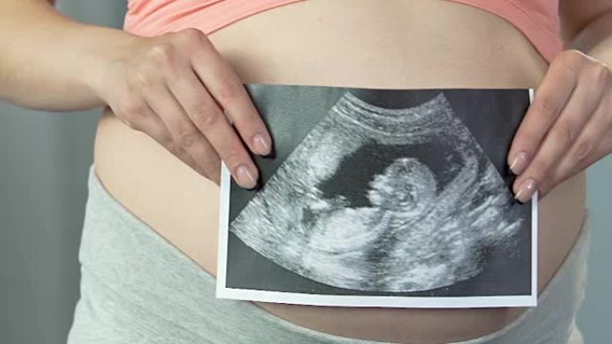 准妈妈拿着超声波图对着胃，孩子的出生预期