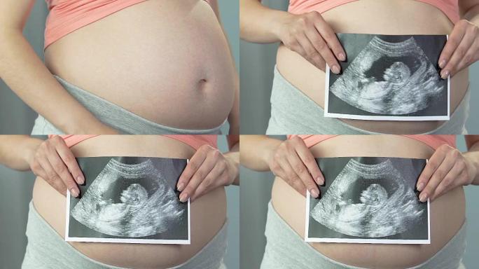 准妈妈拿着超声波图对着胃，孩子的出生预期