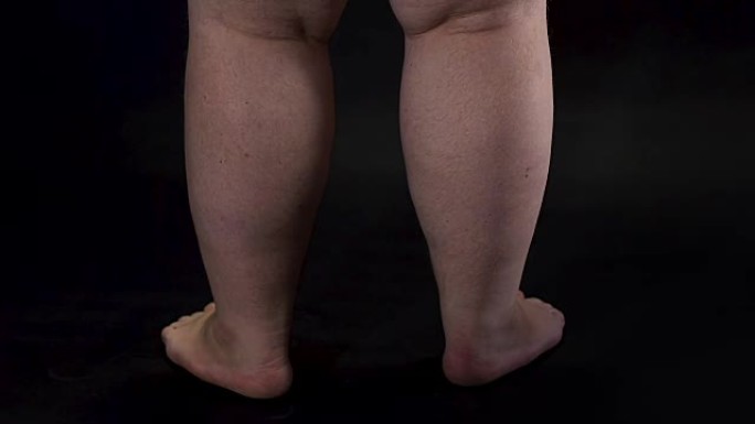 肥胖男性腿转暗背景身体护理不健康营养