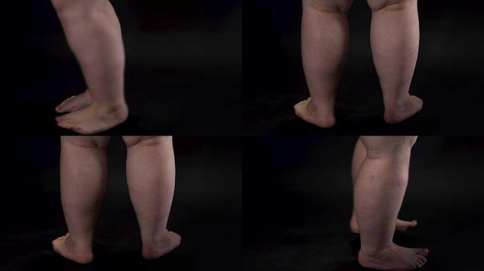 肥胖男性腿转暗背景身体护理不健康营养