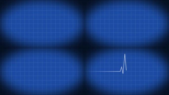 蓝色背景上的心率监测器。动画