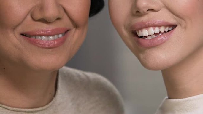 两个漂亮的女人表现出完美的微笑，牙科护理，健康生活方式