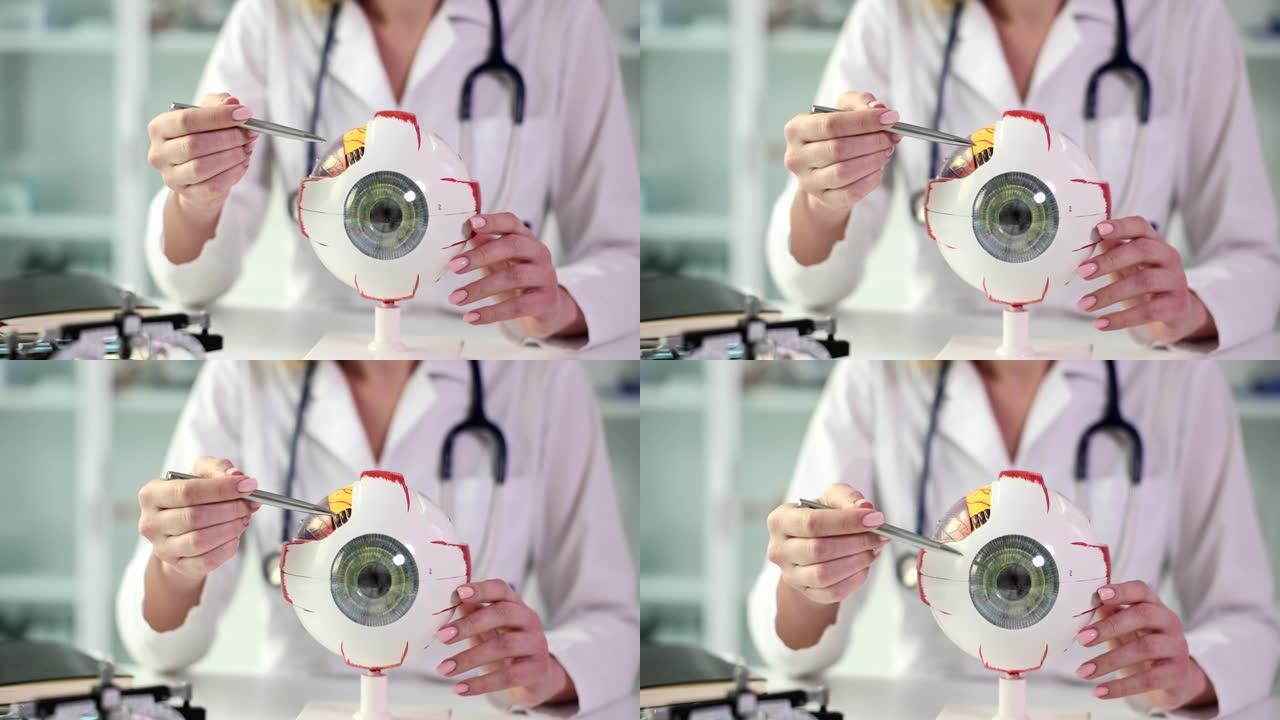 眼科医生手握人眼和笔的解剖模型