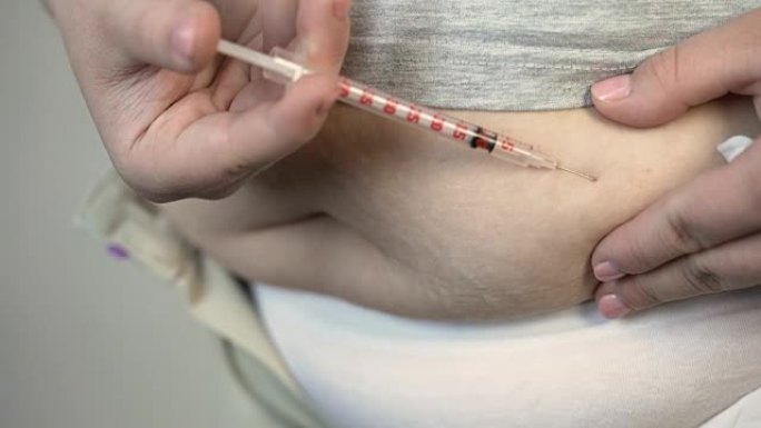 肥胖的妇女向胃注射疫苗，糖尿病和医疗保健
