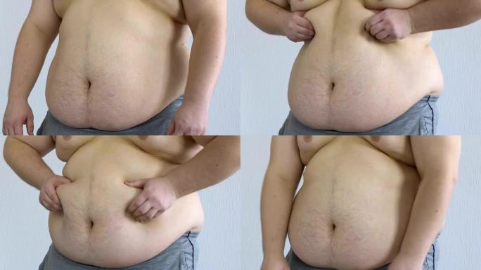 悲伤的男性检查他的肥胖身体，触摸胃，妊娠纹和脂肪团