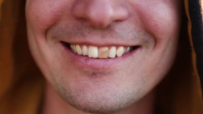 黄色受损的牙齿微笑的高加索人在引擎盖特写。专注于牙齿，张开嘴。牙齿问题，死牙，牙釉质美白，美学修复。
