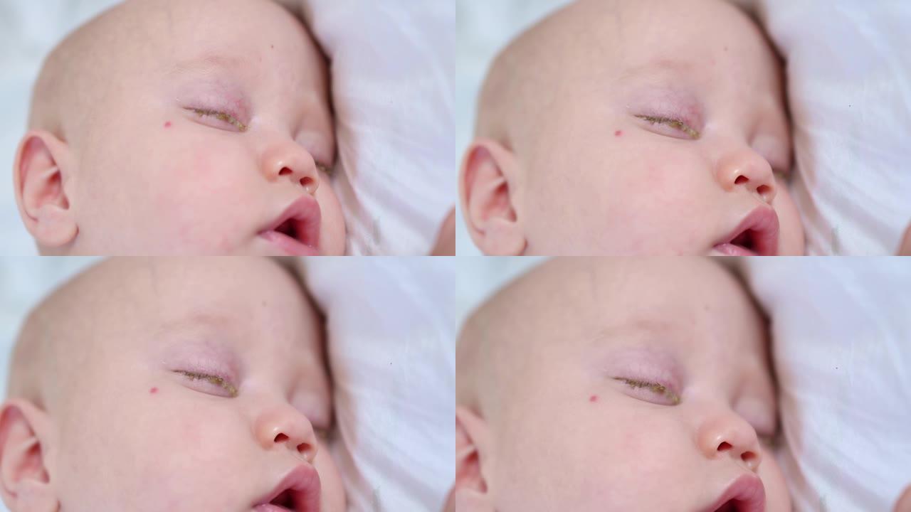 新生儿特写镜头中结膜炎结痂粉红色眼睛睡觉的婴儿肖像
