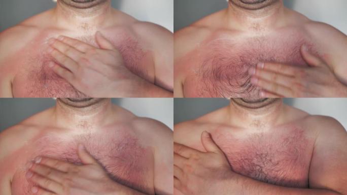 特写男士胸手涂抹舒缓润唇膏乳液，防止晒伤皮肤。