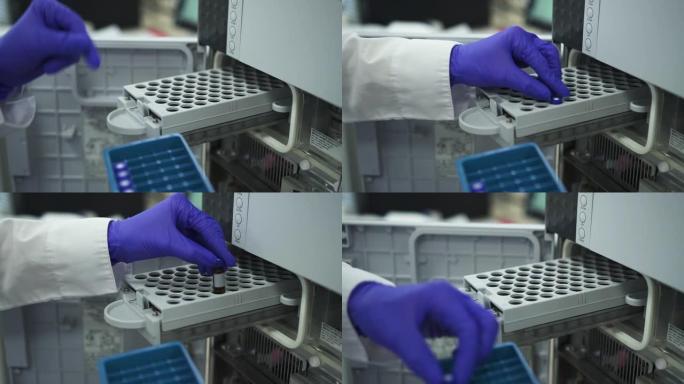 装有试管的现代生化分析仪。spbd遗传学工作者插入试管