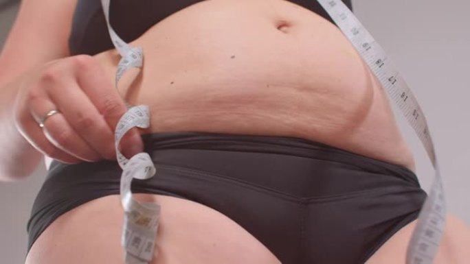 腹部脂肪。一个女人手里拿着一个测量仪。