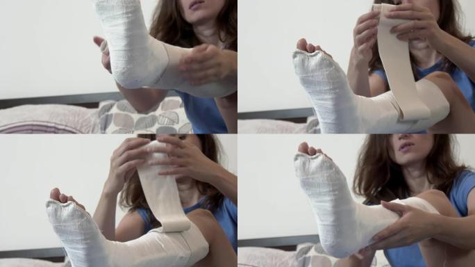 一个穿着石膏绷带坐在床上的女人从腿上取下了弹性绷带。腿部骨折，腿部骨折。25 FPS，缩小。