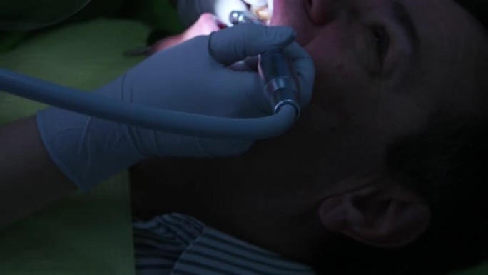 牙医治疗病人上颚的牙齿
