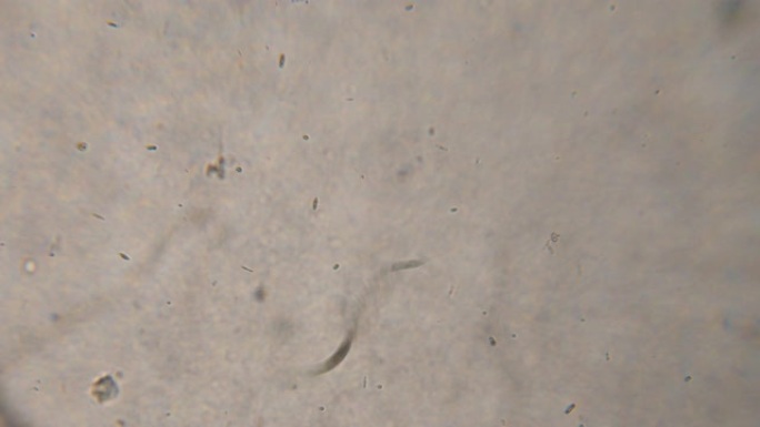 显微镜下饮用水中的细菌寄生虫和蠕虫。显微镜下的线虫蠕虫，蛔虫中的寄生虫: round虫，pin虫，旋