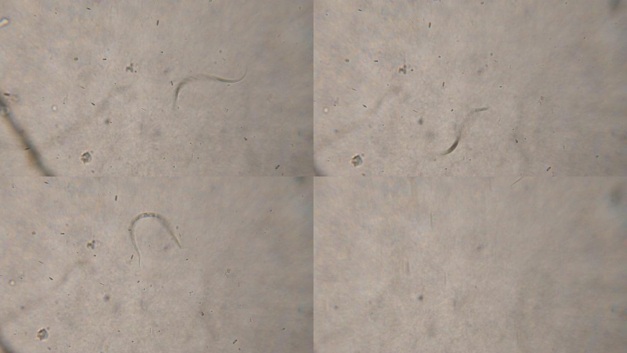 显微镜下饮用水中的细菌寄生虫和蠕虫。显微镜下的线虫蠕虫，蛔虫中的寄生虫: round虫，pin虫，旋