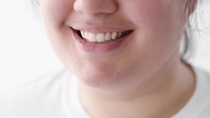 牙齿护理牙齿美白超重女人微笑